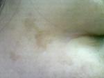 右シミ　2008/11/11　KIREI_SN342795.JPG